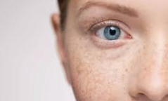 7 Ways How to treat freckles on the face?